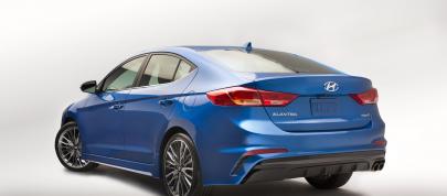 Hyundai Elantra Sport (2017) - picture 4 of 15