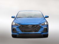 Hyundai Elantra Sport (2017) - picture 1 of 15