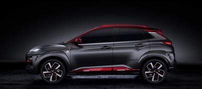 Hyundai Kona Iron Man Edition (2019) - picture 4 of 6